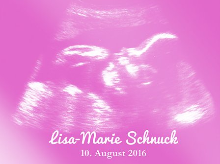 Personalisiertes Ultraschallbild - Mädchen - 2 Personalisiertes Ultraschallbild - Mädchen - 2